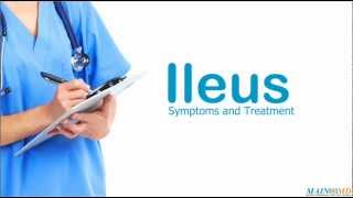 Ileus Symptoms and Treatment [upl. by Tolley823]