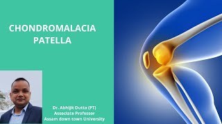 CHONDROMALACIA PATELLA [upl. by Mayer]