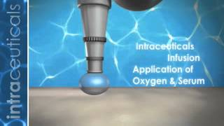 INTRACEUTICALS MADONNAS OXYGEN FACIAL MACHINE [upl. by Adnawyek]