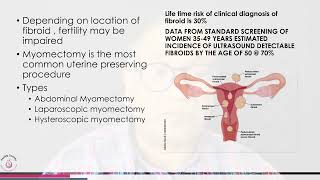 Myomectomy  which type and fertility impact [upl. by Lyrehc532]