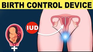 Your LongTerm Birth Control Option  IUD and Pregnancy What You Need to Know [upl. by Einnaj]