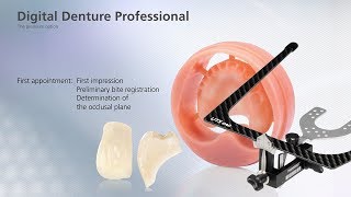 Digital Denture – first Appointment [upl. by Aterg811]