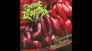 Cerebral Incubation  Gonhorrea Nodule Mastication Full Album 2012 HD [upl. by Oppen]