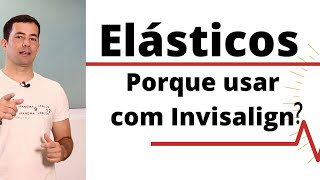 Elásticos porque usar com Invisalign [upl. by Adalheid]