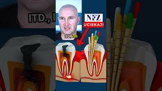 😱Leczenie🦷 na NFZ😳 leczeniekanałowe nfz dentystaopole stomatologopole mikrostomart [upl. by Baxter]