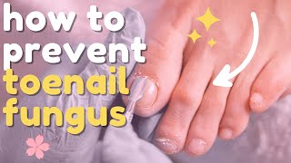 4 WONDERFUL TIPS FOR PREVENTING TOE NAIL FUNGUS KEEP YOUR FEET HEALTHY [upl. by Nyltiac]