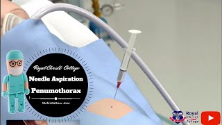 Surgey  Pneumothorax Needle Aspiration Surgery Simulation How to remove a peneumothorax [upl. by Carhart]