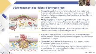 Lien entre dyslipidémie et athérosclérose  mécanismes et épidémiologie [upl. by Munshi768]