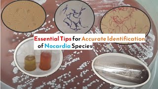 Essential Tips for Accurate Identification of Nocardia Species [upl. by Marcus]