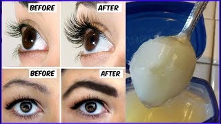 How To Grow Thicker Eyebrows amp Eyelashes In Just 14 Days  100 Working  Simple Beauty Secrets [upl. by Corri806]