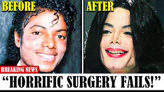 30 Times Plastic Surgery Went Horribly Wrong here goes my vote [upl. by Enneirda]