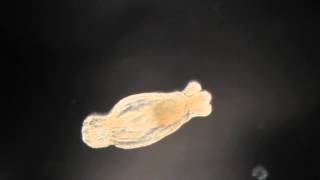 Nematostella vectensis Developing Polyp BIOHOPK 160H [upl. by Arabella]