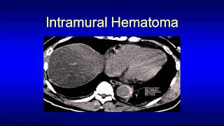 When Do I Need a noncontrast CT [upl. by Fowle]