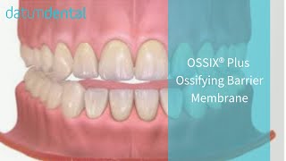 OSSIX PLUS Resorbable Collagen Dental Membrane 2014 [upl. by Vince804]