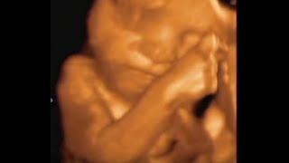 What do babies do in the womb Incredible 4D scan of FETUS eating crying and SNEEZING [upl. by Orianna502]