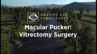 Retina Macular Pucker Vitrectomy [upl. by Aleciram67]