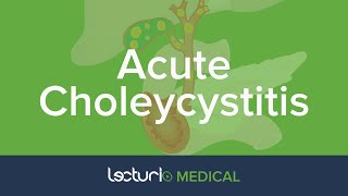 Acute Choleycystitis Overview and Practice Case  Gastroenterology [upl. by Bickart]