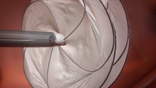 GORE® CARDIOFORM Septal Occluder PFO Animation [upl. by Eipper]