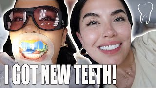 MY TEETH JOURNEY  BEFORE VENEERS AND AFTER [upl. by Neelyt]