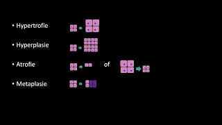 Begrippen in de pathologie Hypertrofie Hyperplasie Atrofie Metaplasie en Dysplasie [upl. by Koeppel588]