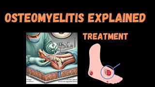 Osteomyelitis Explained [upl. by Macknair550]