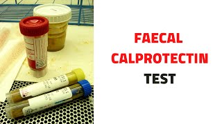 FECAL STOOL CALPROTECTIN TEST Uses Inflammatory Bowel Disease [upl. by Eiramacissej]