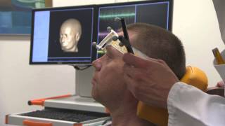 Navigated Brain Stimulation for presurgical mapping and tractography [upl. by Ytirahs75]