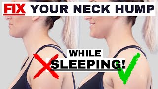 BEST sleeping position to FIX Neck Hump Hunchback or Forward Head Posture  Dr Jon Saunders [upl. by Nichani]