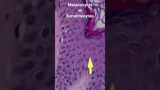 Melanocytes vs Keratinocytes From my normal skin histology 101 video pathology dermpath usmle [upl. by Noreen]