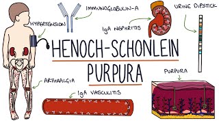 HenochSchonlein Purpura Visual Explanation for Students [upl. by Sigfried]