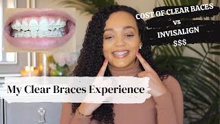 My Braces Experience  Invisalign vs Clear Braces Cost Breakdown [upl. by Niamert]