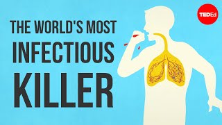 What makes tuberculosis TB the worlds most infectious killer  Melvin Sanicas [upl. by Jentoft158]