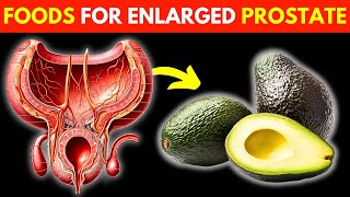 Eat These NATURAL Foods Everyday To Shrink an Enlarged Prostate [upl. by Loos593]