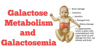 Galactose metabolism  Biochemistry [upl. by Annnora]