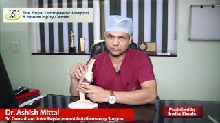 Ligament Injury Introduction By  Dr Ashish Mittal  लिगामेंट इंजरी क्या है चोट का कारगर इलाज [upl. by Reyotal367]