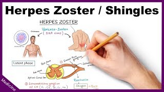 Herpes ZosterShingles Symptoms Diagnosis Treatment [upl. by Ange67]