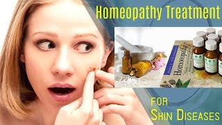 Sulphur for Skin Diseases  Pimples  Homeopathy  Dr Ketan Shah  MD Homeopathic [upl. by Kahle]