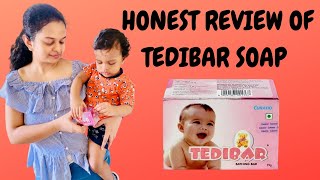 MUST WATCH TEDIBAR soap Honest review TAMIL  Baby fairness soap   Pros and Cons of soap [upl. by Marelya]