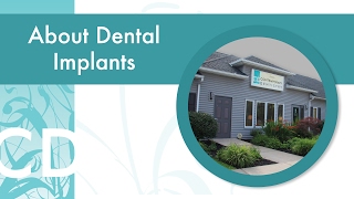 Dental Implants Rochester NY [upl. by Neliak]