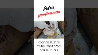 Peritoneum covering the pelvic viscera pelvic cellular tissue shorts peritoneal pelvis [upl. by Haimes977]