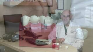 Dental Implants 101 What You NEED to Know Part 1 Implant Basics [upl. by Litt]