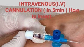 INTRAVENOUS  IV  CANNULATION  in 5 min  How to insert ivcannula youtube viral doctor [upl. by Lesya926]