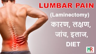 Lumbar Laminectomy in hindi What is lumbar laminectomy prevention after lumbar laminectomy [upl. by Ethe907]