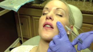 Botox amp Juvederm Lip Injection in Virginia by Dr Naderi DC VA MD [upl. by Naples]