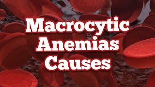 Causes of Macrocytic Anemias  Mnemonic [upl. by Bonar]