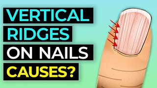 10 Things Your Nails Can Tell You About Your Health [upl. by Danczyk]