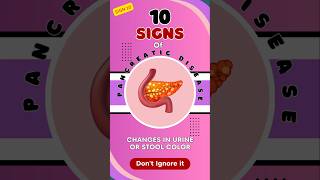 10  Pancreatic Disease Alert Dark Urine or Pale Stools Warning Signs You Shouldn’t Ignore [upl. by Ariaec262]