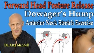 Forward Head Posture Release Dowagers Hump Anterior Neck Stretches  Dr Mandell [upl. by Bubalo747]