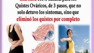 Quistes De Ovario Simples Riesgos Y Tratamiento Para Curarlos [upl. by Reece]