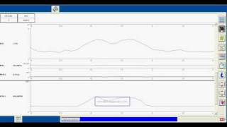 Ford IDS particle filter DPF regeneration and datastream recording [upl. by Abas504]